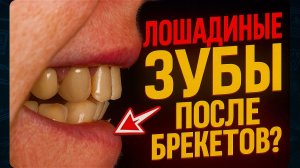 Лошадиные зубы после брекетов