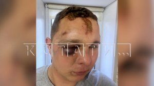 Посетитель концерта обвиняет ЧОПовцев в зверском избиении, они его —  в потребительском экстремизме