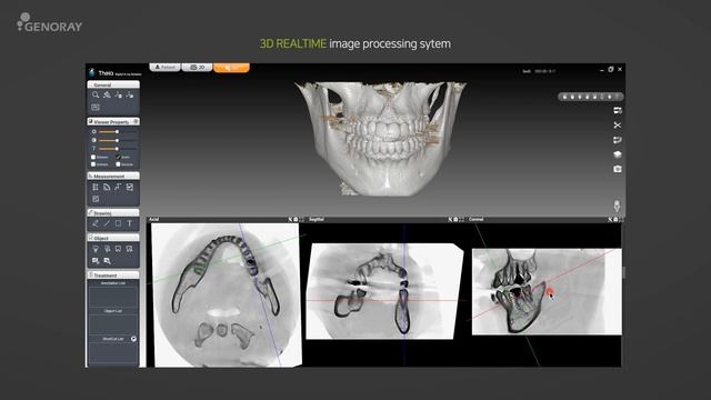 Genoray Imaging Software_Theia смотреть онлайн