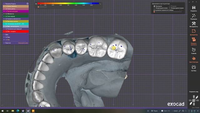 Формирование фиссур #1 смотреть онлайн