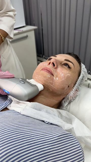 Результаты SMAS лифтинга в клиниках 