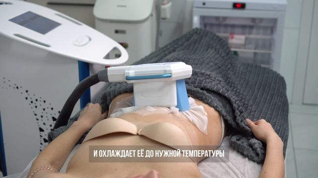 Криолиполиз в клиниках 