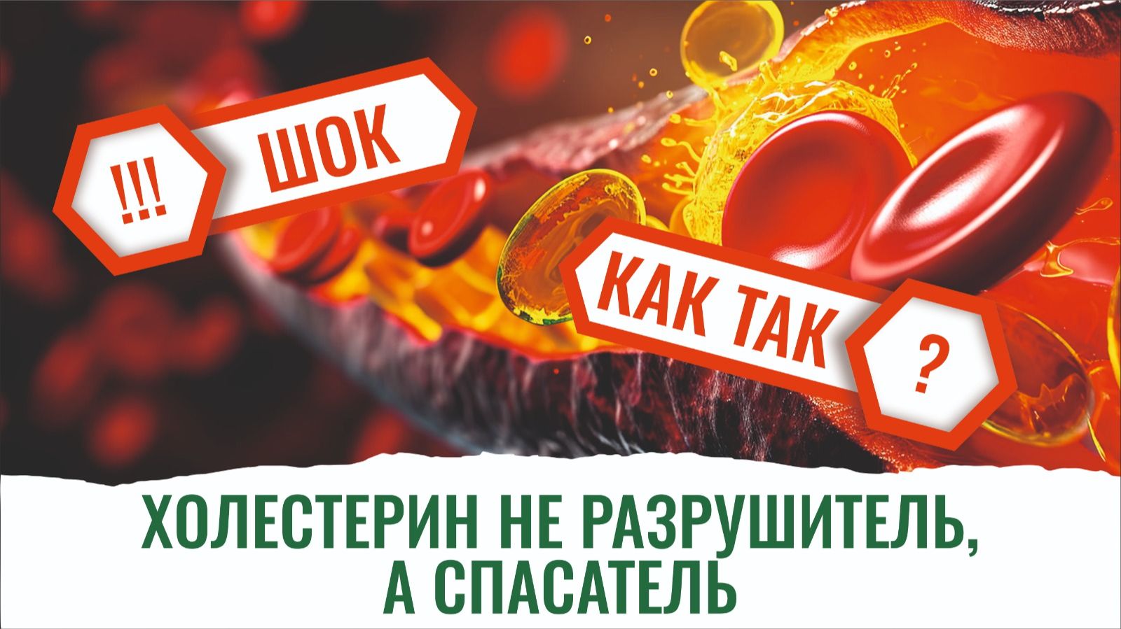 Высокий холестерин? Не беда! Врач Валикова разъясняет, почему. смотреть онлайн