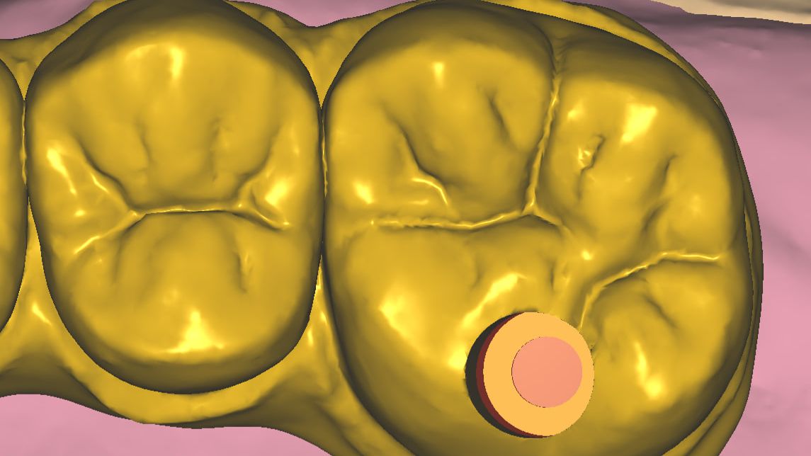 Формирование фиссур #2 смотреть онлайн