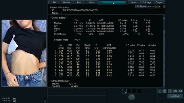 МАСТЕР-КЛАСС: «ФИБРОЗ, СТЕАТОЗ, ГЕПАТИТ-КОМПЛЕКСНАЯ ОЦЕНКА ДИФФУЗНОЙ ПАТОЛОГИИ ПЕЧЕНИ» ПОСТНОВА Н.А