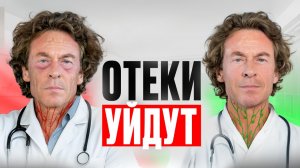 ИЗБАВЬСЯ ОТ ЗАСТОЯ ЛИМФЫ! 5 способов ОЧИСТИТЬ ЛИМФУ+УПРАЖНЕНИЯ