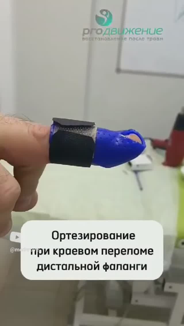 👉 Ортезирование при краевом переломе дистальной фаланги