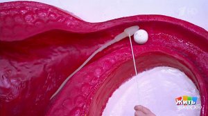 Таблетка, что изменила секс: свобода и лечение в одной упаковке. Жить здорово! Фрагмент выпуска о...