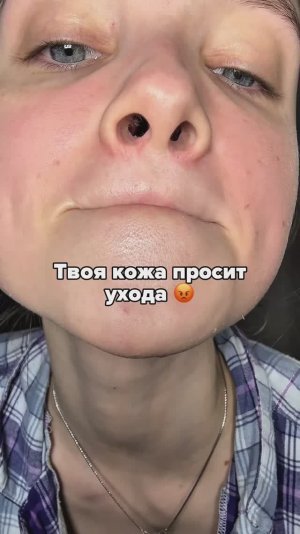 Избавляюсь от неровностей на коже