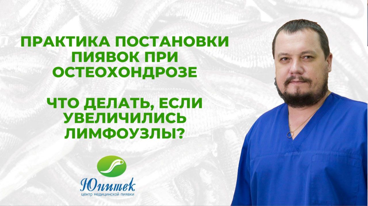 Постановка пиявок при остеохондрозе. Увеличение лимфоузлов: что делать?