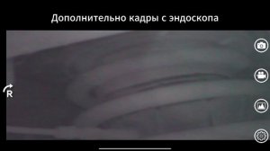 Пневмобаллоны, часть 1