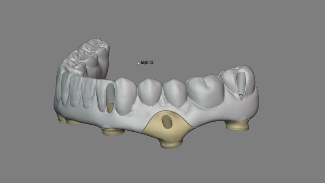 Балочная конструкция с разделением одного из сегментов смотреть онлайн