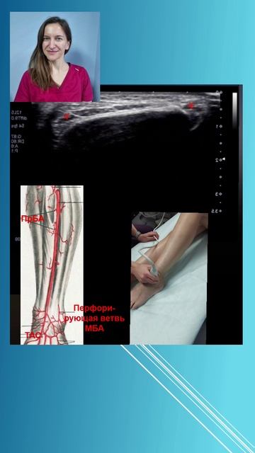 УЗИ. Замещение ПрБА МБА. Баркова Елена Дмитриевна (online-video-cutter.com)