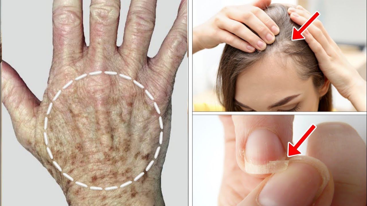 ВАЖНЫ ДЕФИЦИТЫ ПИТАТЕЛЬНЫХ ВЕЩЕСТВ | ДОКТОР ВИВЕК смотреть онлайн