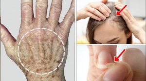 ВАЖНЫ ДЕФИЦИТЫ ПИТАТЕЛЬНЫХ ВЕЩЕСТВ | ДОКТОР ВИВЕК