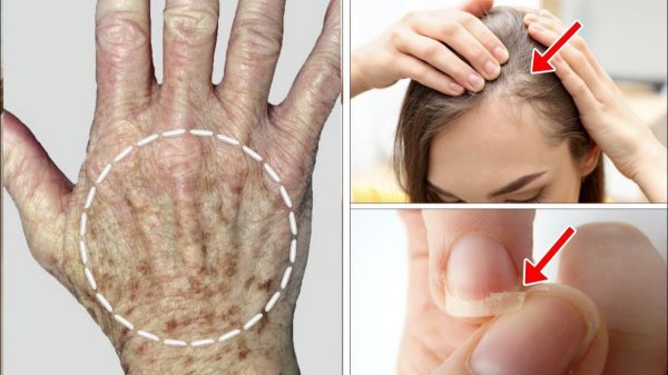 ВАЖНЫ ДЕФИЦИТЫ ПИТАТЕЛЬНЫХ ВЕЩЕСТВ | ДОКТОР ВИВЕК