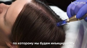 Протокол мезотерапии кожи головы