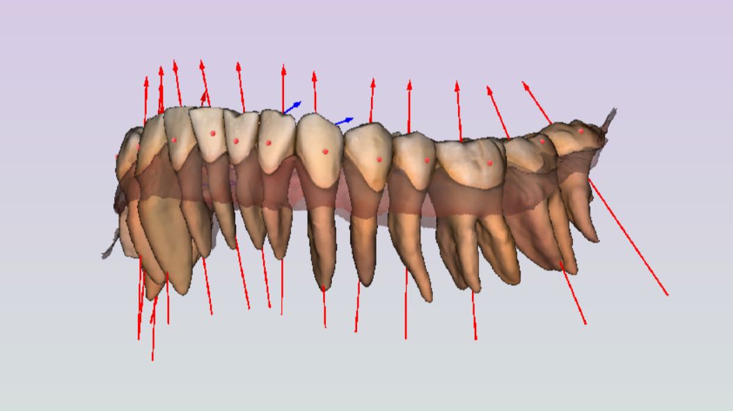 Импорт корней из КТ в Maestro 3D. смотреть онлайн