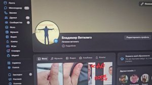 ВНИМАНИЕ! ВИТИЛИГО!СМОТРЕТЬ ВСЕМ!