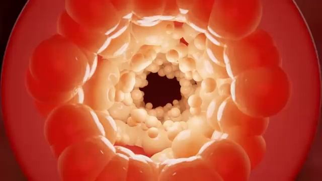 Матрица Гаряева. Очистка сосудов от холестерина смотреть онлайн