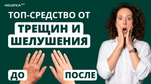 Сухость рук и трещины? Домашняя процедура за 5 минут для идеально гладкой кожи