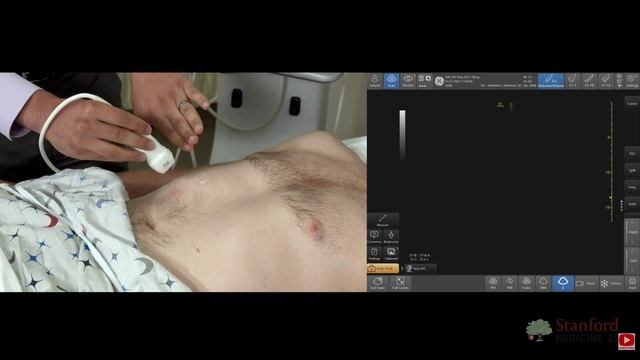 10 Point of Care Ultrasound of the Gallbladder