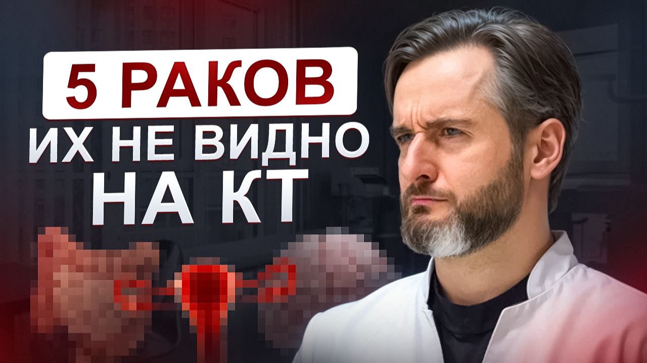 КТ всего тела: 5 видов рака, которых не видно. Как тогда искать? Врач объясняет