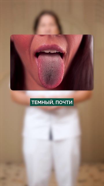 ЧТО ваш язык ГОВОРИТ о вашем ЗДОРОВЬЕ?! Быстрая диагностика! #здоровье #язык #диагностика смотреть онлайн
