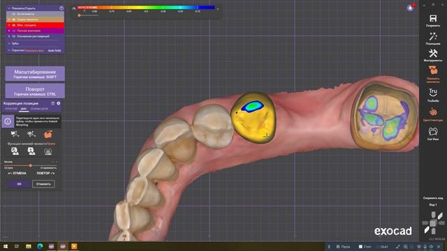 Самый сложный случай 45-48 смотреть онлайн