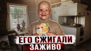 ОТЕЦ СЖЕГ ЗАЖИВО ДВУХ МАЛЕНЬКИХ СЫНОВЕЙ | История Алеши Буштаренко из Бурятии