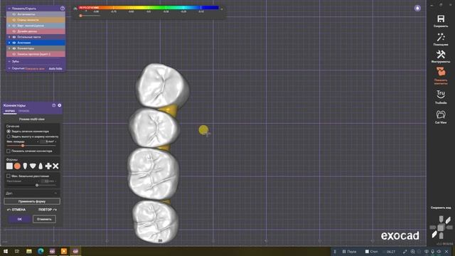 Частично-съемный на жевалки смотреть онлайн