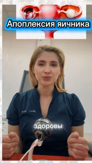 Апоплексия яичника