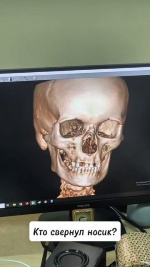 КТО СВЕРНУЛ ИРИШКЕ НОСИК? ПАША ГОВОРИТ ЧТО НЕ ОН! ВСЁ БУДЕТ ЧИКИ ПИКИ