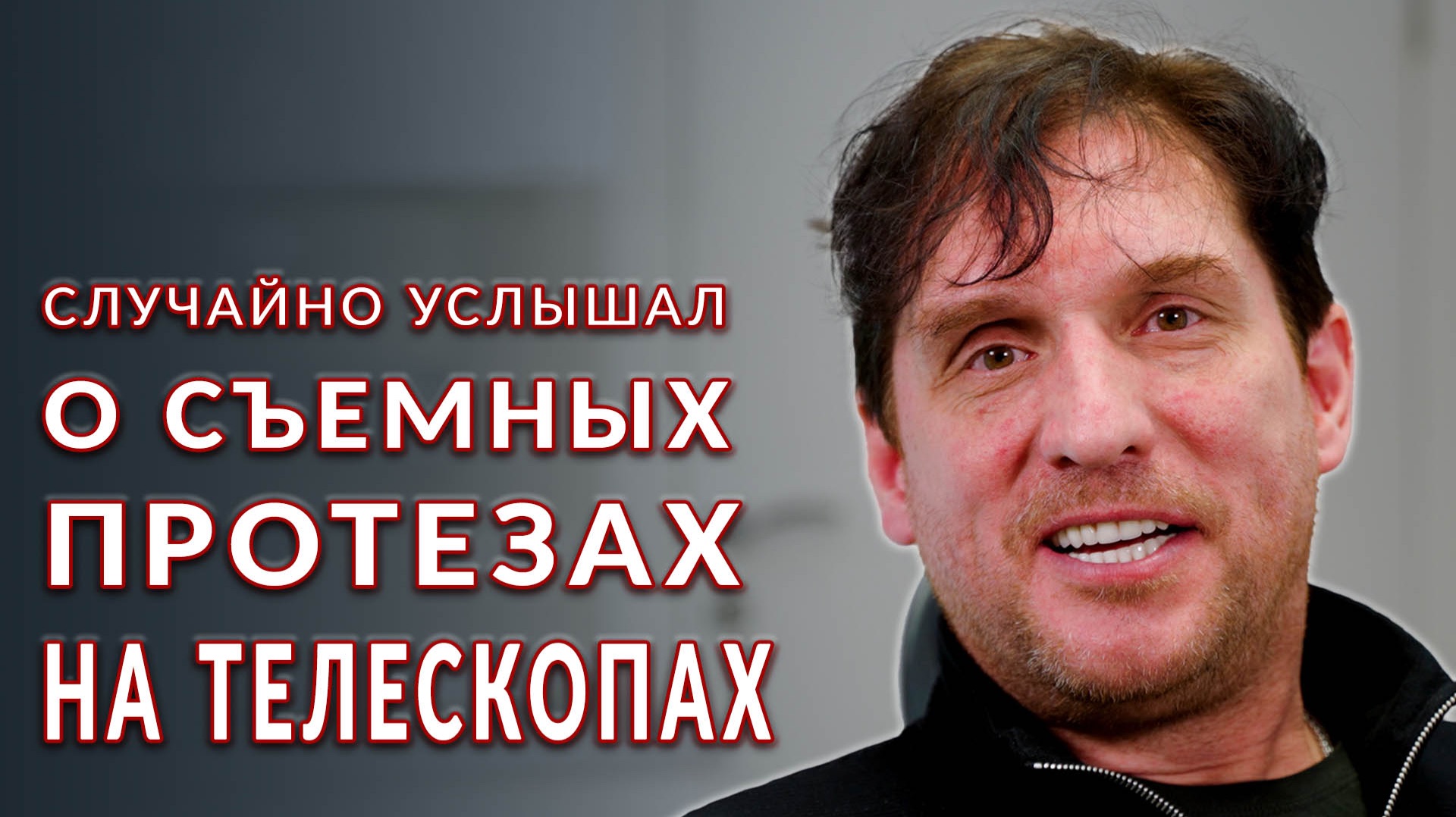 Пациенту сделали два полных съемных протеза кандулор на телескопах. смотреть онлайн