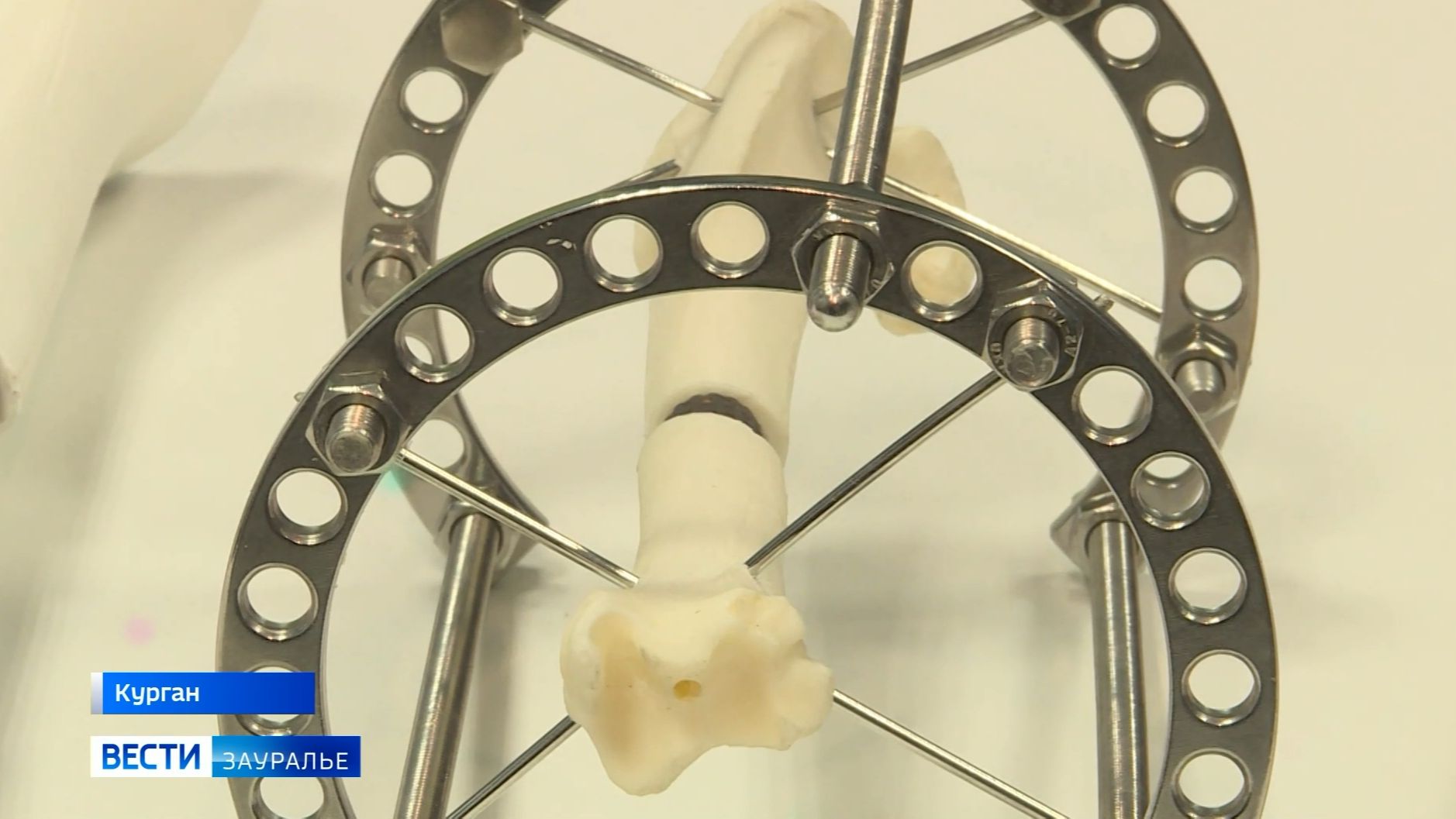 Курганские учёные в сотрудничестве с Центром Илизарова разрабатывают модульные титановые имплантаты смотреть онлайн