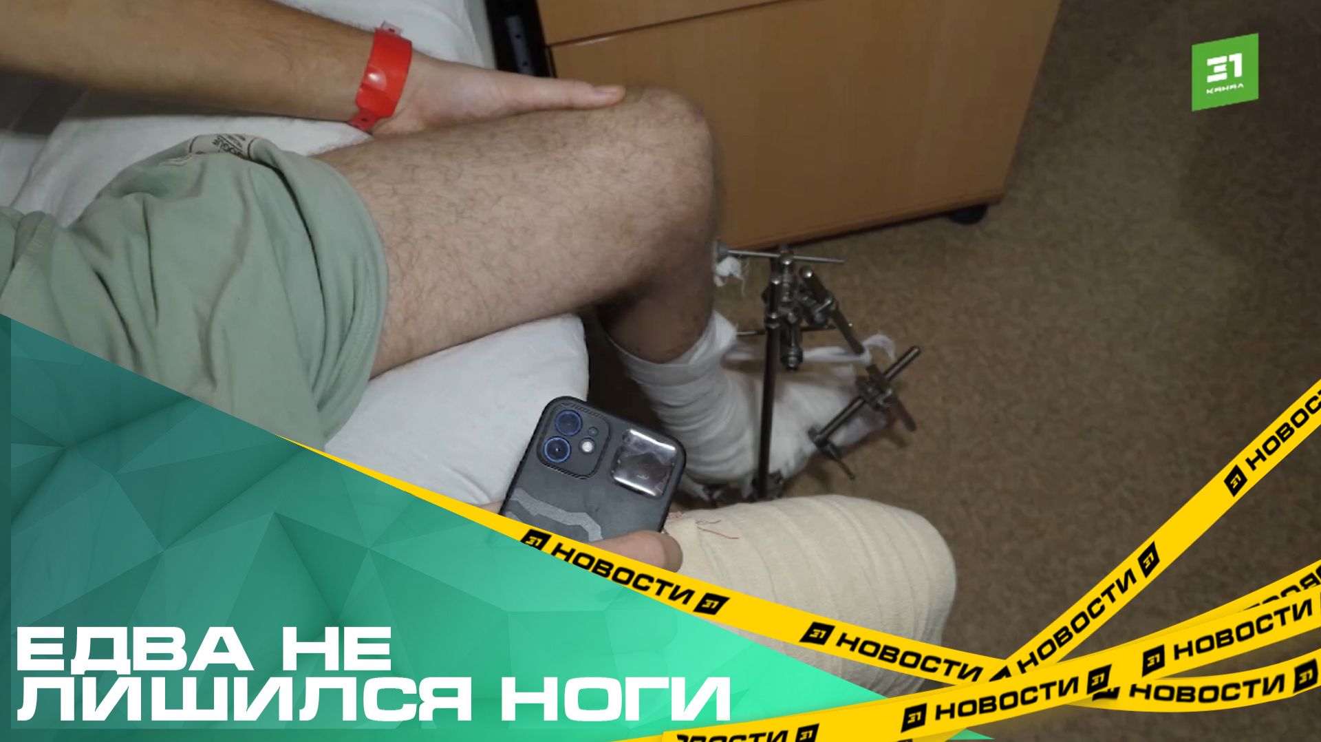 Едва не лишился ноги. Хирурги спасли конечность 21-летнему челябинцу смотреть онлайн