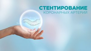 Лечение сердца по ОМС - стентирование