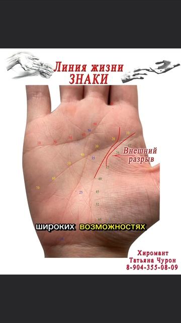 Линия Жизни. Внешний разрыв. Знаки. Хиромантия.