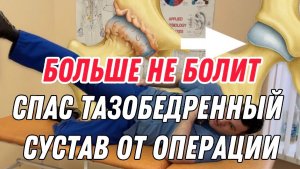 Тазобедренный сустав больше не болит после этого упражнения