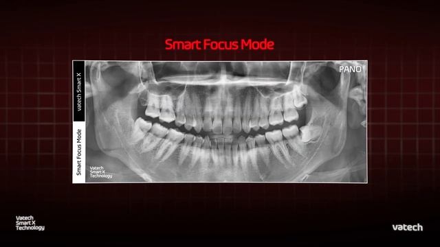 Vatech Smart X — Your Gateway to Dental Excellence смотреть онлайн