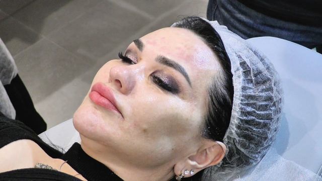 Ёлки иголки или больно не будет! Практическая часть с Романом Комлевым