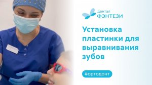 Установка пластинки для выравнивания зубов