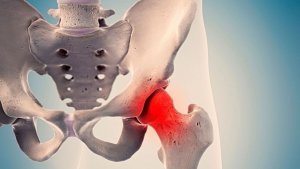 Сеанс кинезиологии. Боль в тазобедренном суставе.