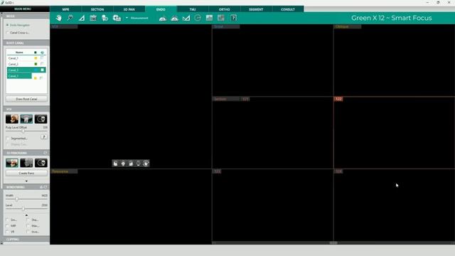 Vatech Green X 12 — Smart Focus software смотреть онлайн
