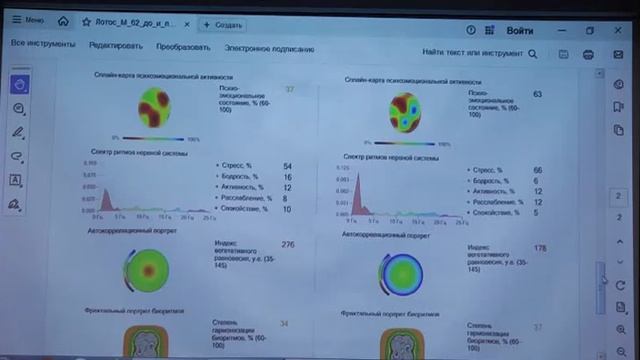 Исследователь, парапсихолог, кибернетик Эльмира Скиба, Новокузнецк. Диагностика действия фуллерена.
