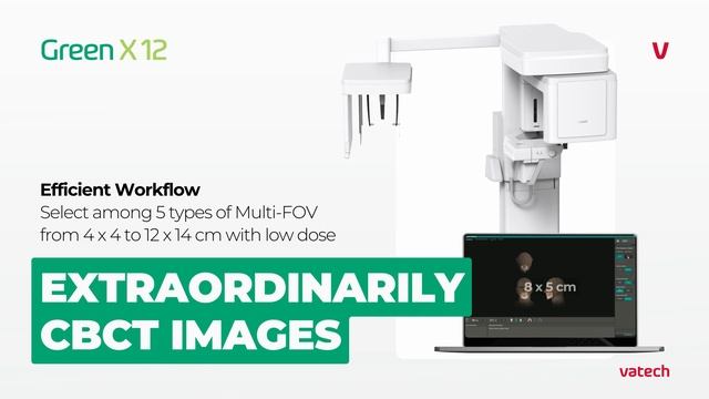 Vatech Green X 12 — Multi-FOV смотреть онлайн