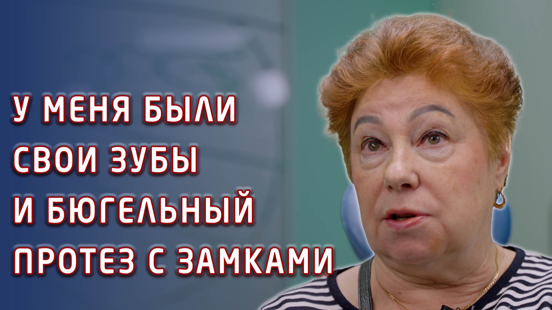 Отзыв пациентки о бюгельном протезировании и имплантах. смотреть онлайн