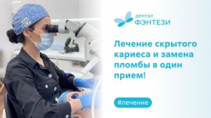⭐ Лечение скрытого кариеса и замена пломбы в один прием!