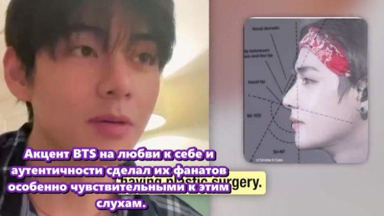 Рассуждения хирурга были особенно интригующими. Он отметил,лицо Ви соответствует золотому сечению... смотреть онлайн