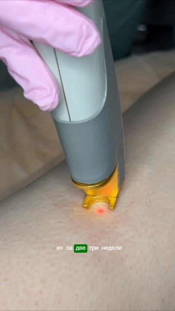 До и после удаления сосудов: рекомендации и ограничения